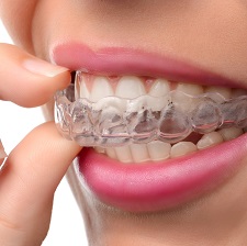 Neviditelná rovnátka Invisalign